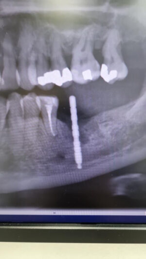 2026C6A1-6FD0-4ADA-A5B5-D99FFC0F796D