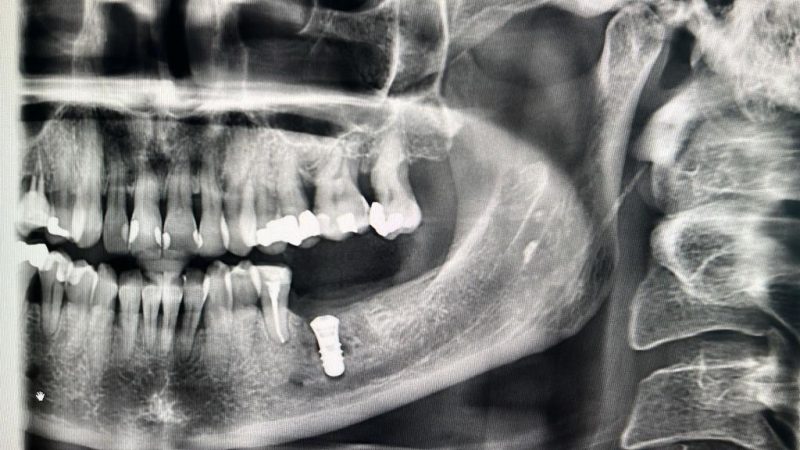 4DC5AC60-2FE2-403A-A4EA-23D76C4F9AA6