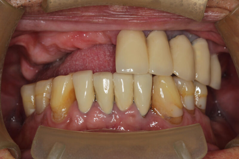 Resto, Enrique 10_24_2024 2D Oral_Facial Photo Images