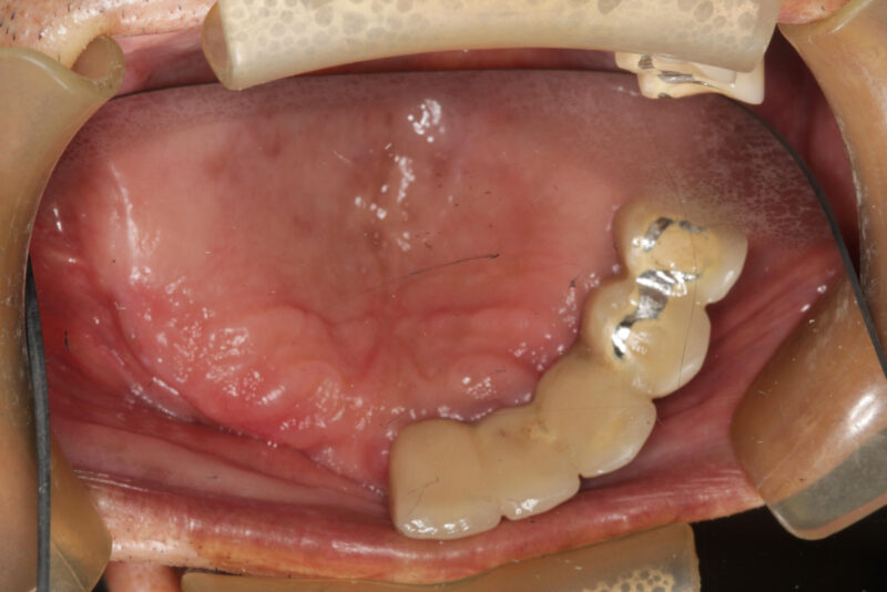 Resto, Enrique 10_24_2024 2D Oral_Facial Photo Images (1)