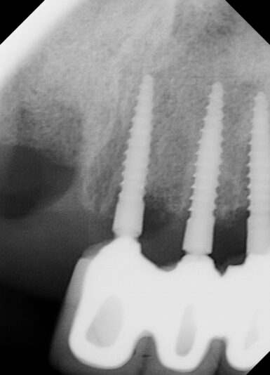 Resto, Enrique 10_24_2024 #10, 11, 12