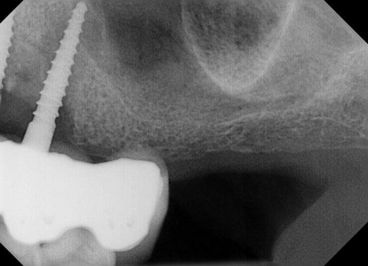 Resto, Enrique 10_24_2024 #12, 13, 14