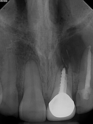 DeJesse, Anthony 02_26_2025 #9