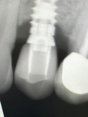 69749905500__31E240A7-BA75-47F4-86C9-DD7D6A61E91B