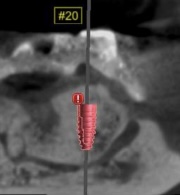 00FA581A-3FDE-4BDE-8D20-748D341F0C50