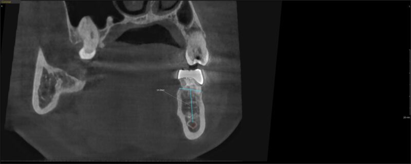 CI20221121_160728_4957_59059844