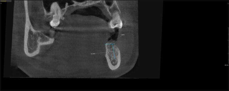 CI20230320_165040_4904_37508507