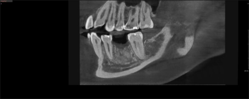 CI20230320_165048_5523_98946584