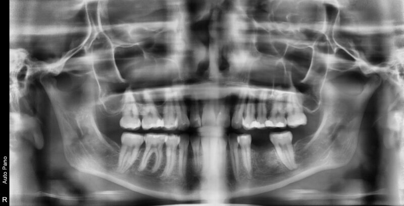 PX20230317_161821_7681_41079303