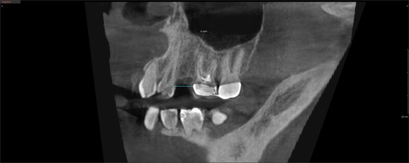 CI20230320_145408_1031_88292964