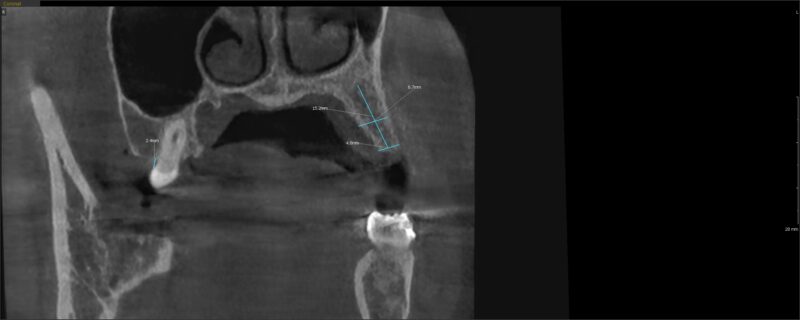 CI20230320_145350_1202_58416430