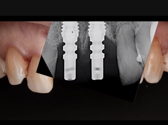 Screen Shot 2023-03-25 at 9.56.35 AM