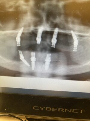 3E9FD887-34BC-4D53-B3E8-47A644E230C0