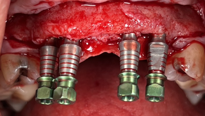 Screen Shot 2023-05-06 at 10.26.26 PM