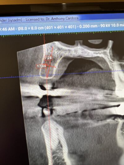 453B7E25-A205-4768-BF63-1383FF2AC631