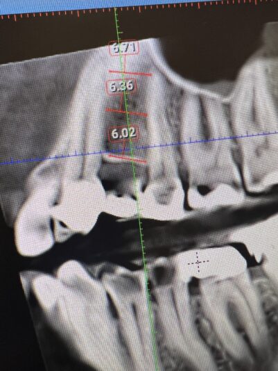 71CD66F2-98EF-4C49-ABDC-B44522AA738C