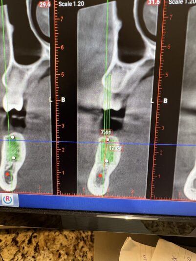 532F9595-1D81-417C-85D8-981EB67D27EB