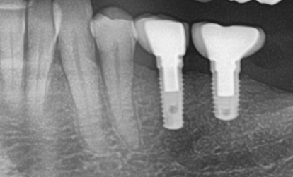 Screenshot 2024-01-08 133413