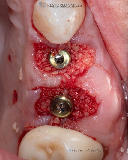 7EF43FA3-A17A-485C-8739-99DED4985CCC