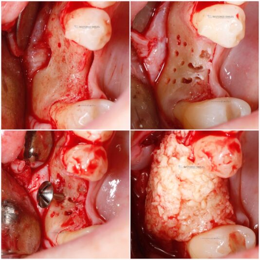 6D87D058-BD0A-4400-A0E0-17E810185C5C