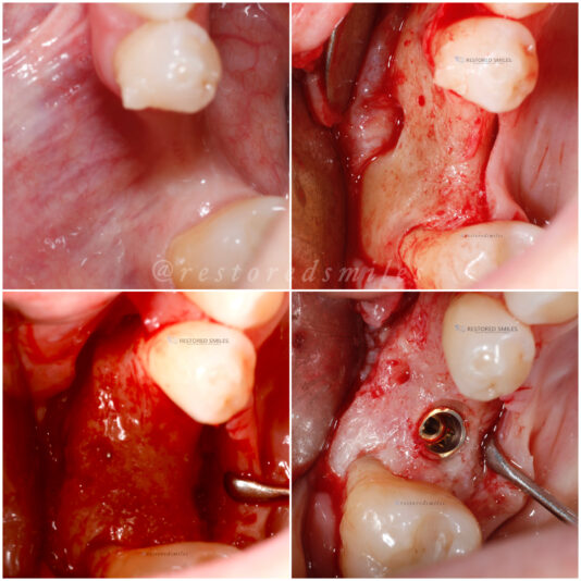 created by photogrid