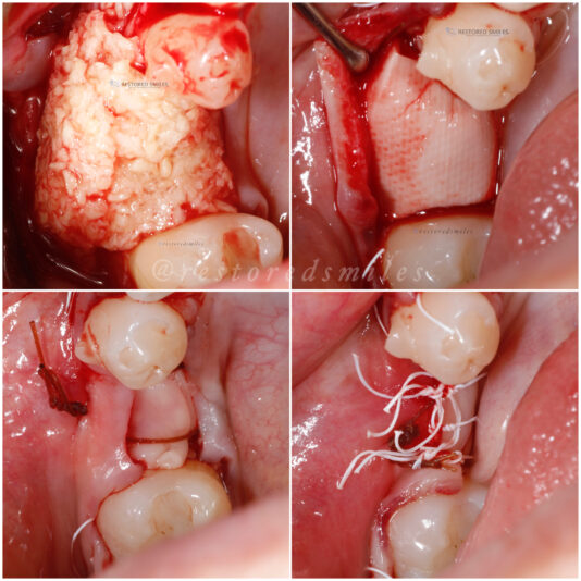 created by photogrid