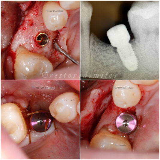 created by photogrid