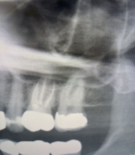 Screen Shot 2024-11-14 at 5.38.49 AM