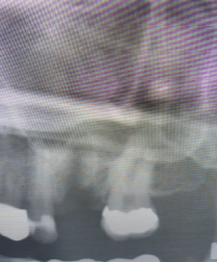 Screen Shot 2024-11-14 at 5.39.03 AM