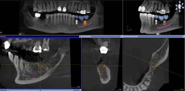 B705FA2C-D932-46E6-87C9-A55035BB6BDD
