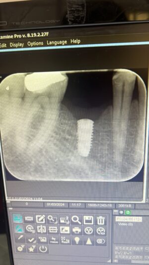 3935F63E-E036-4014-A3F1-BA73A3D80317