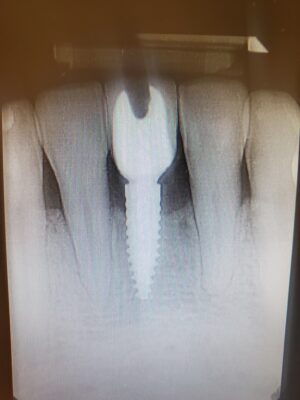 17110299901543049963937049117718