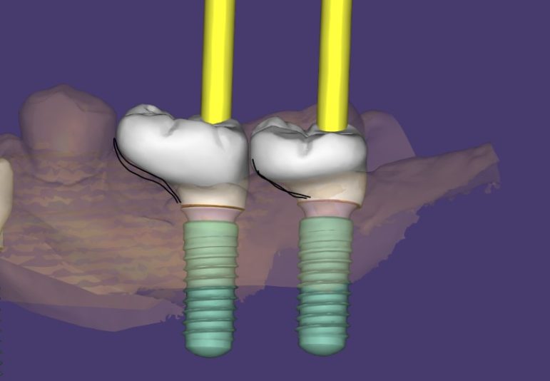 WhatsApp Image 2024-03-25 at 4.01.27 PM