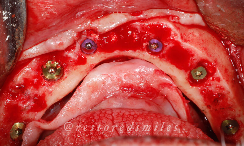 created by photogrid