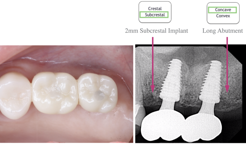 Screenshot 2024-11-20 at 11.06.07 AM