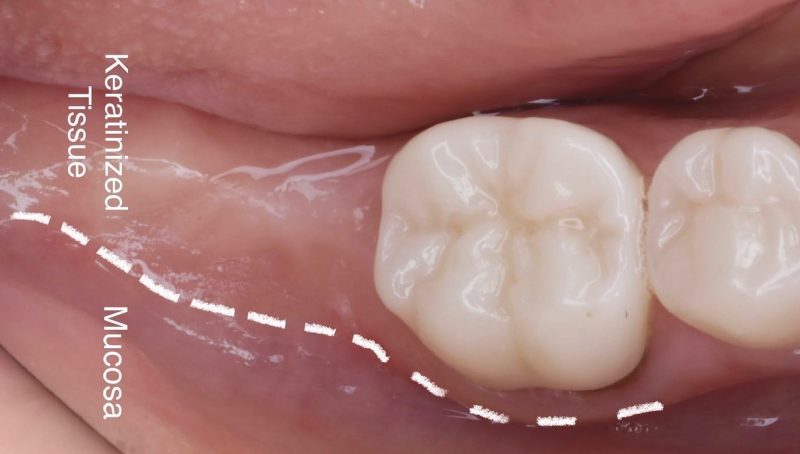 DCA94F44-DC68-4889-AB06-1FB9EBC9604B