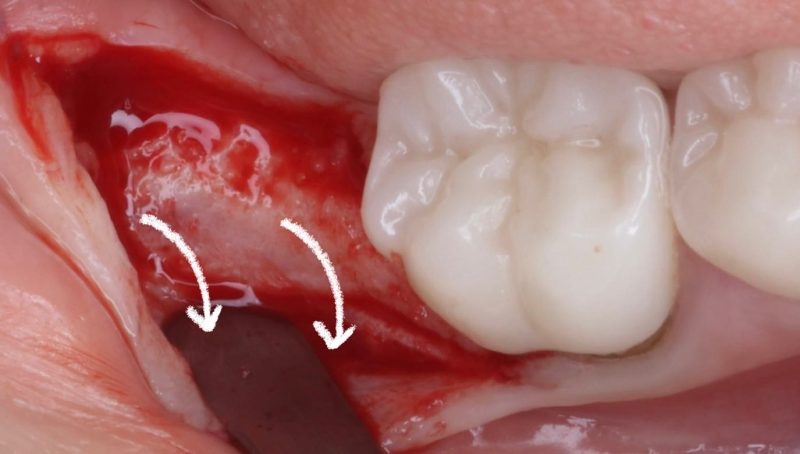 3B527823-A061-4C92-AE9E-3D43BC68311C 2