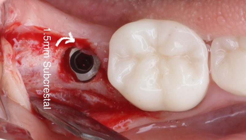 89A82311-5BE0-43D1-816E-C9182B7AF692