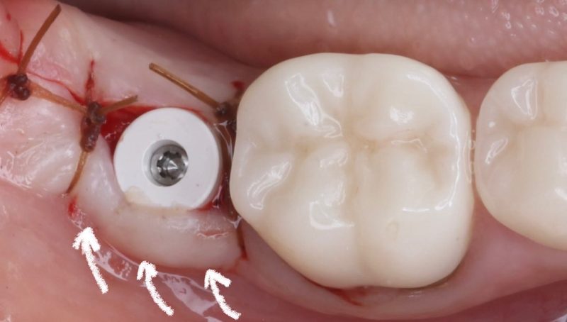 A673C105-A31D-4D9D-98F3-AE7EAC3CE03F