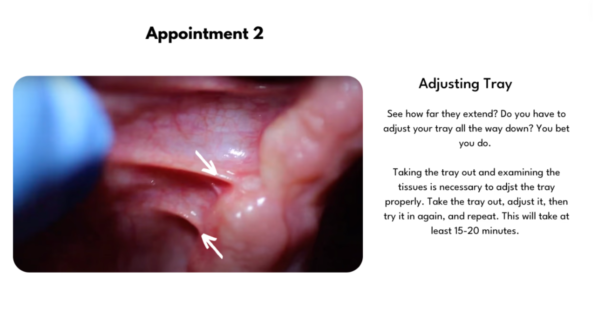 The Overdenture Cookbook - Image 7