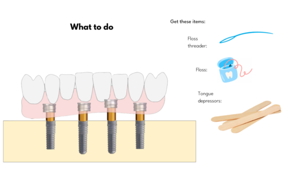 The Overdenture Cookbook - Image 5